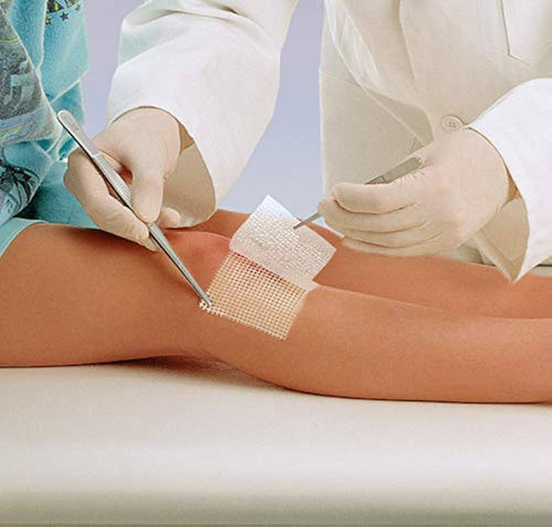 Atrauman Non-Adherent Dressing